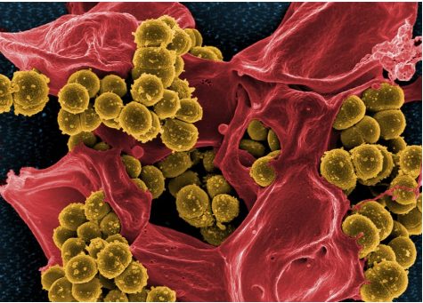 PC: National Institute of Allergy and Infectious Diseases